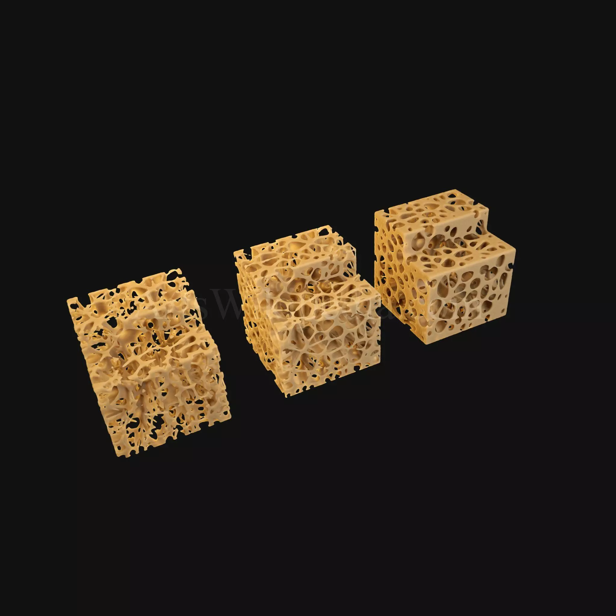 3D Normal vs Osteopenia vs Osteoporosis 3D model_0