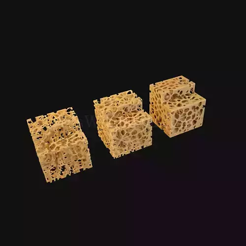 3D Normal vs Osteopenia vs Osteoporosis 3D model
