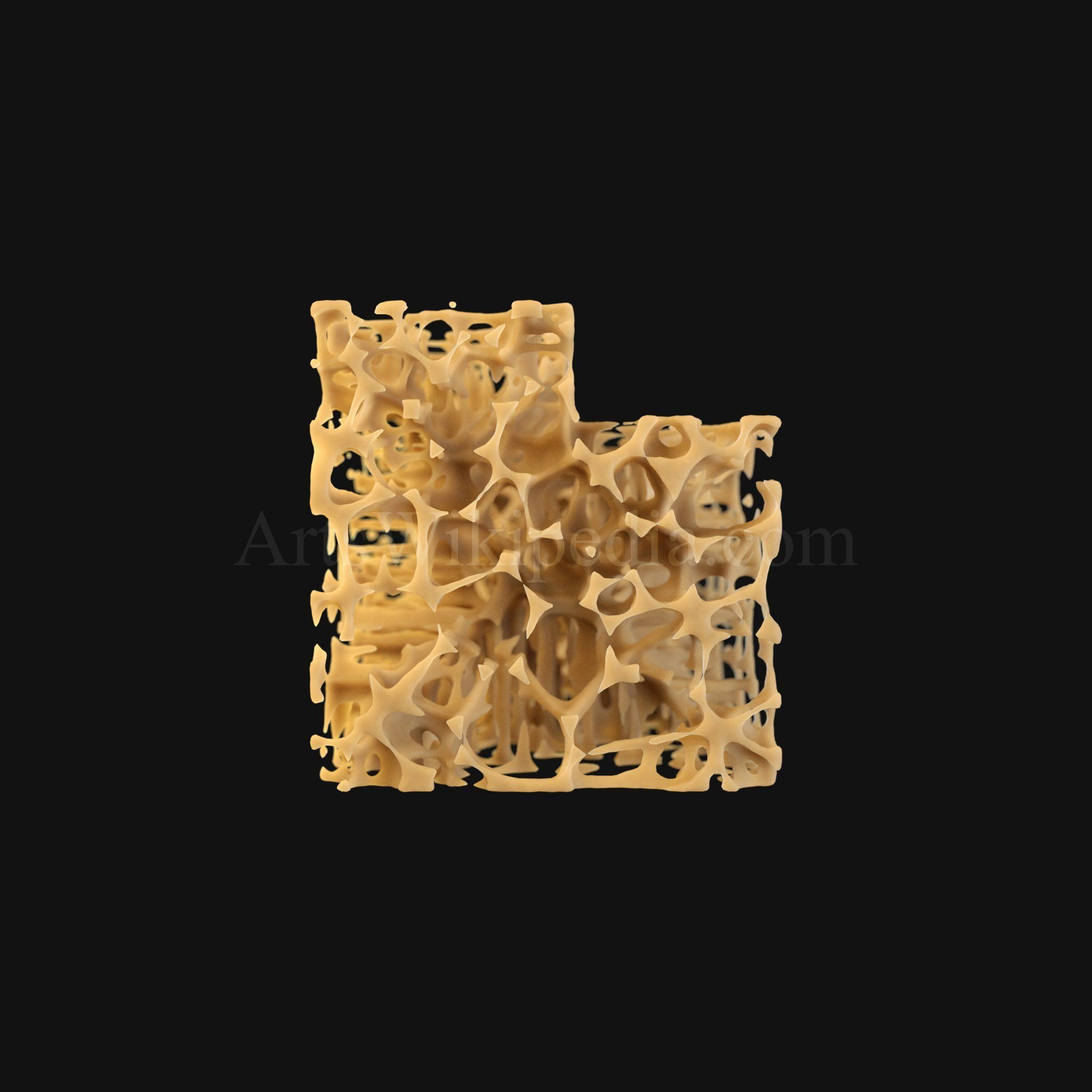 3D Normal vs Osteopenia vs Osteoporosis 3D model_3