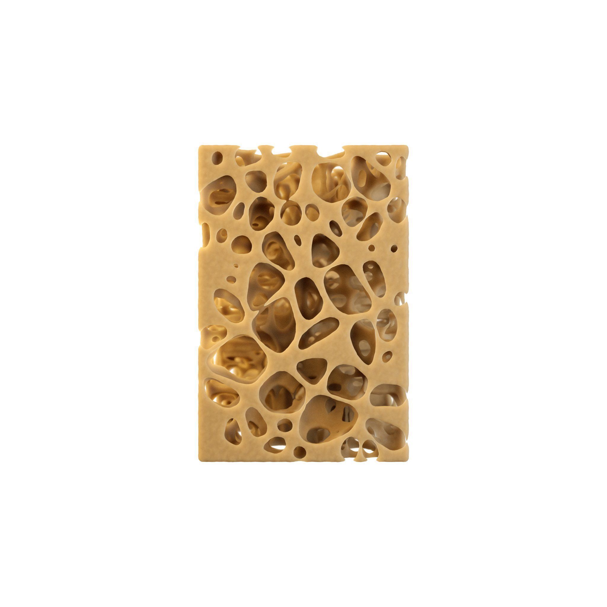 3D Spongy Bone Normal vs Osteopenia vs Osteoporosis 3D model_5
