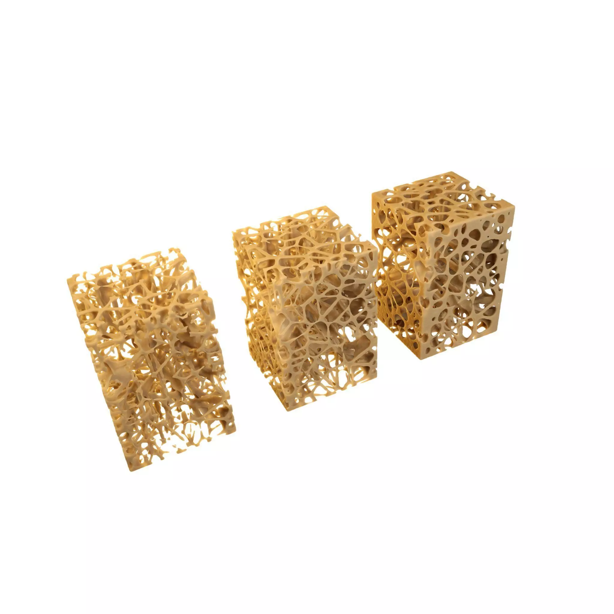 3D Spongy Bone Normal vs Osteopenia vs Osteoporosis 3D model_0