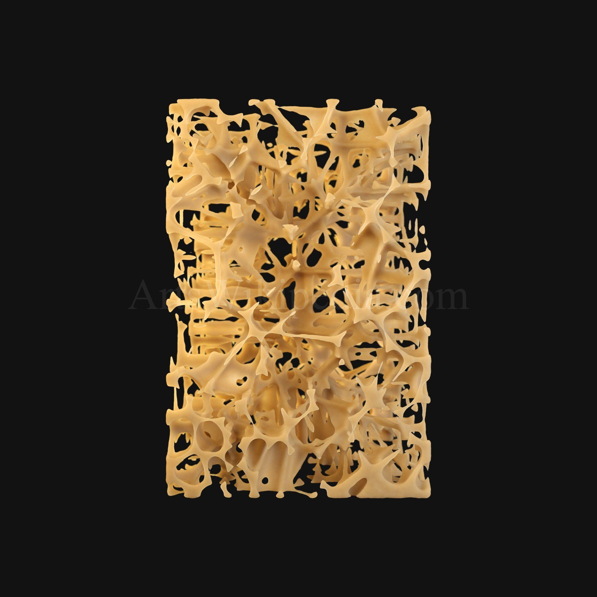3D Osteoporosis Histology of Spongy Bone Structure 3D model_6