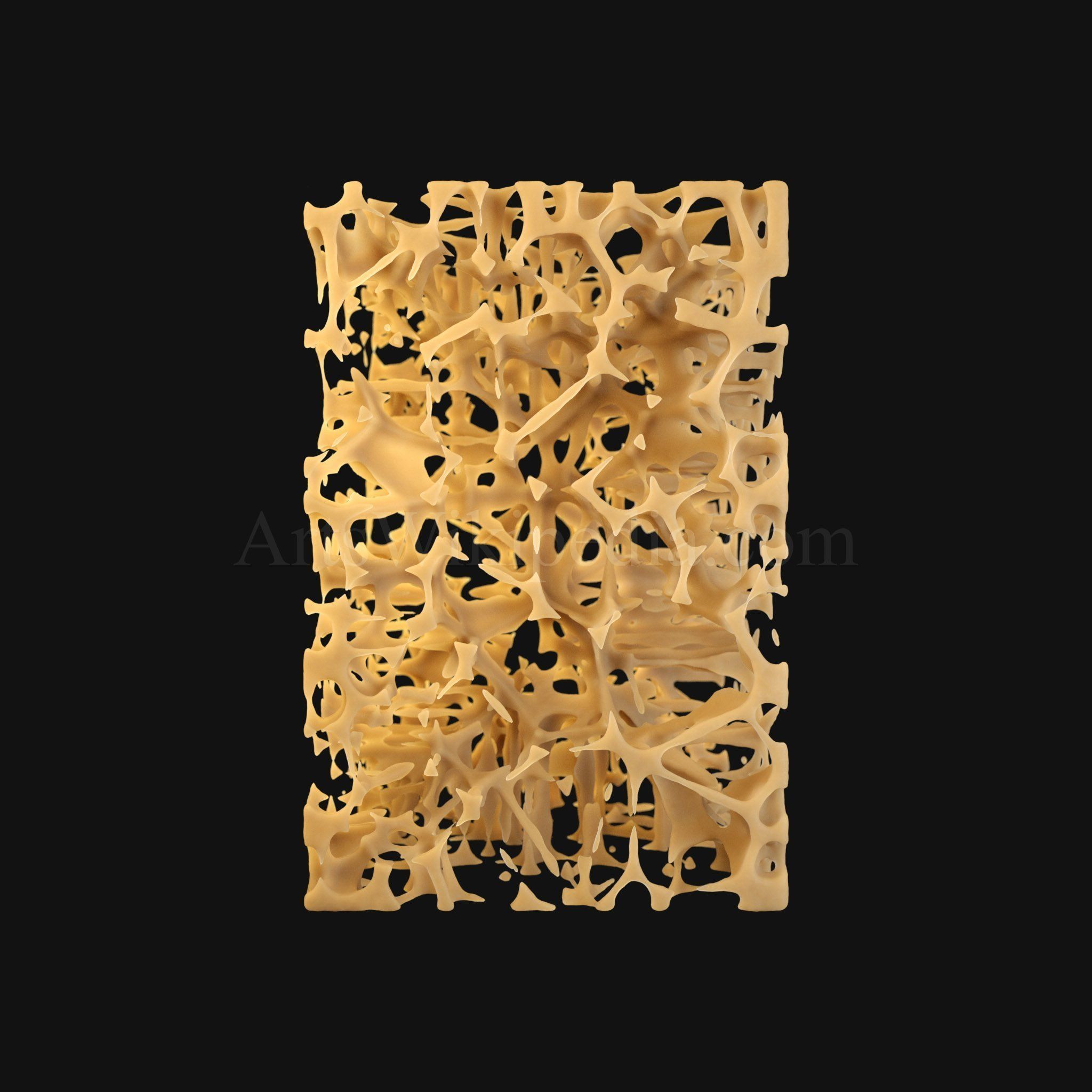 3D Osteoporosis Histology of Spongy Bone Structure 3D model_7