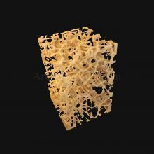 3D Osteoporosis Histology of Spongy Bone Structure 3D model_2