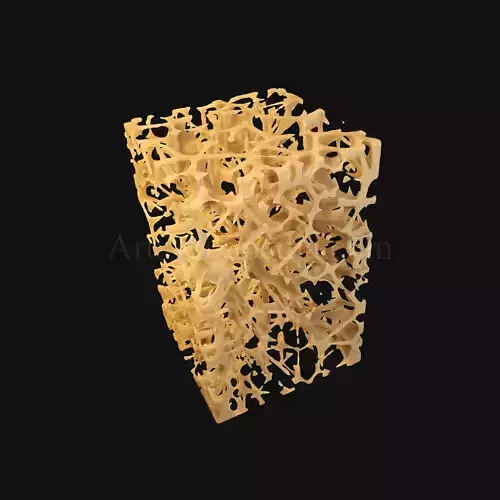 3D Osteoporosis Histology of Spongy Bone Structure 3D model