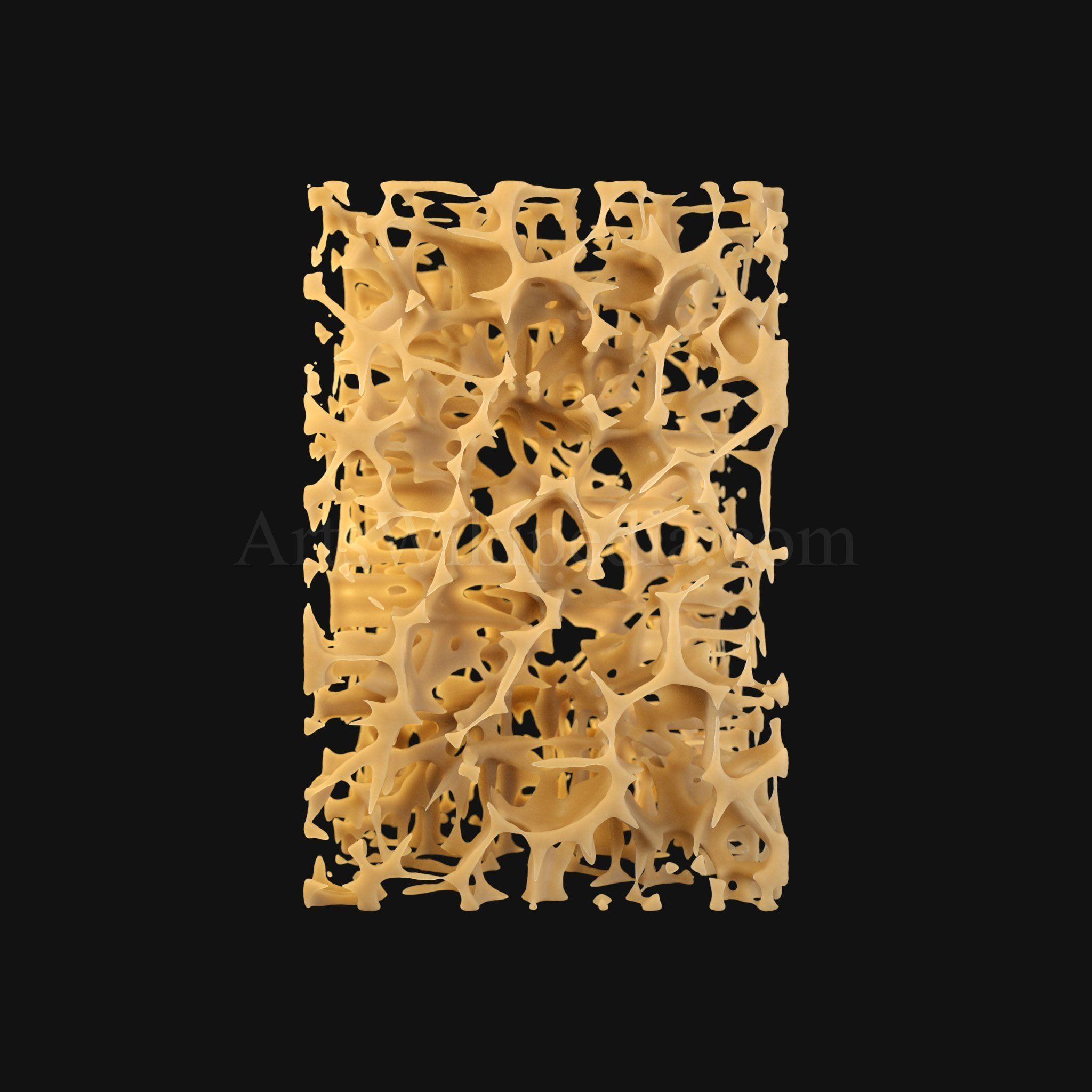 3D Osteoporosis Histology of Spongy Bone Structure 3D model_5