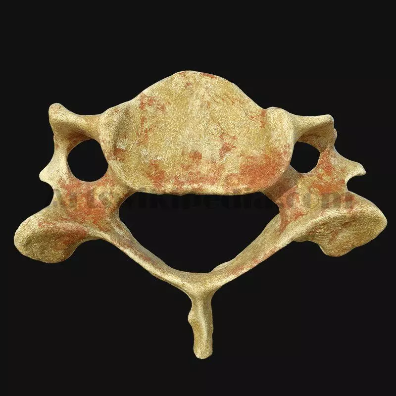 C3 Cervical  Vertebrae 3D model_0