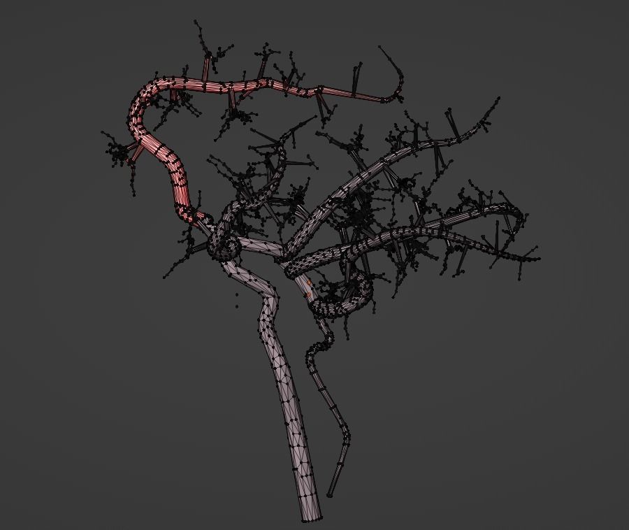 3D Model of Brain and Blood Supply - Circle of Willis 3D model_7