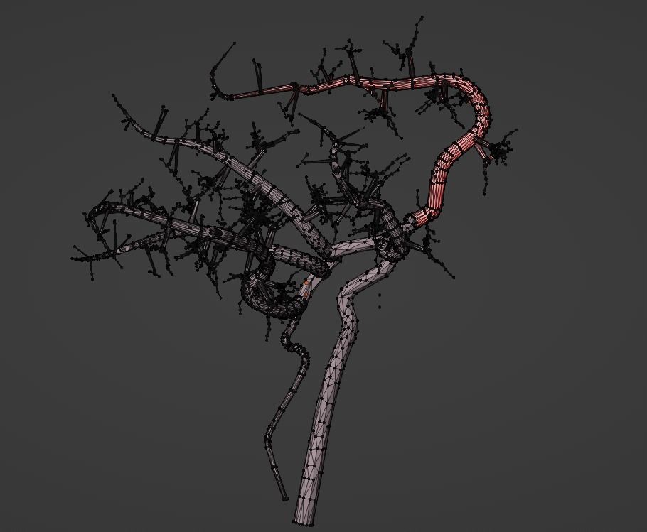 3D Model of Brain and Blood Supply - Circle of Willis 3D model_6