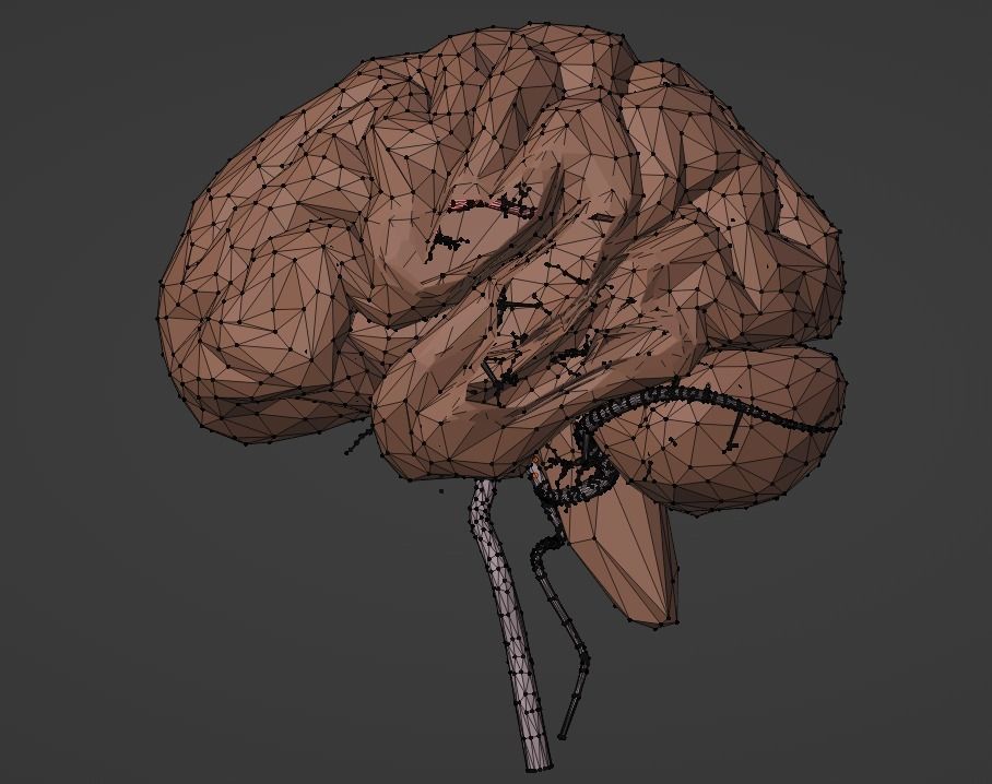 3D Model of Brain and Blood Supply - Circle of Willis 3D model_18
