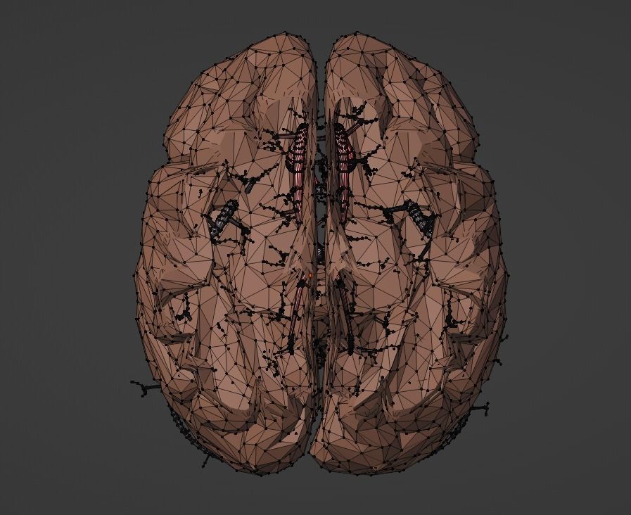 3D Model of Brain and Blood Supply - Circle of Willis 3D model_19