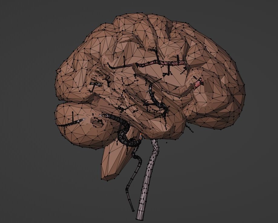 3D Model of Brain and Blood Supply - Circle of Willis 3D model_17