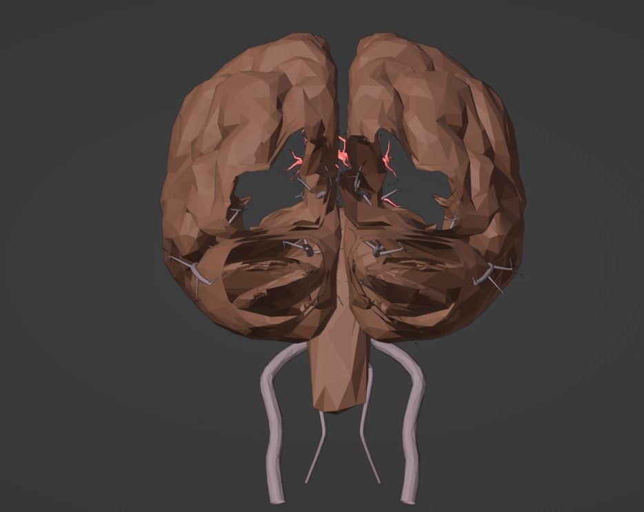3D Model of Brain and Blood Supply - Circle of Willis 3D model_14
