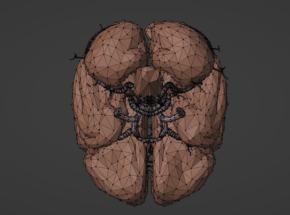 3D Model of Brain and Blood Supply - Circle of Willis 3D model_1