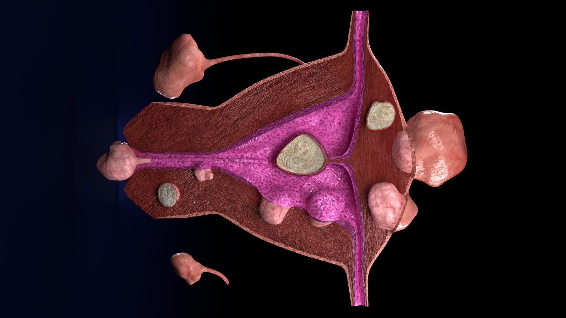 Fibroid Uterus Human female 3D Low-poly 3D model_38