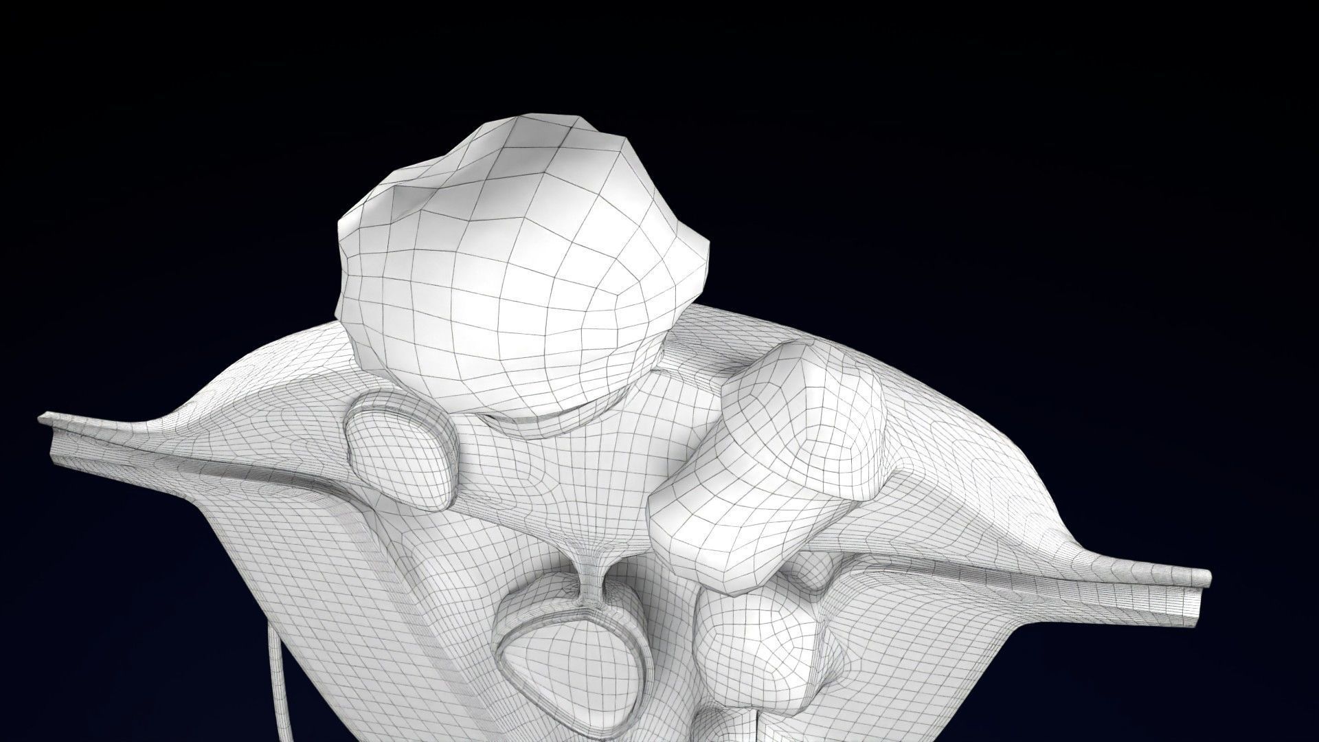 Fibroid Uterus Human female 3D Low-poly 3D model_65