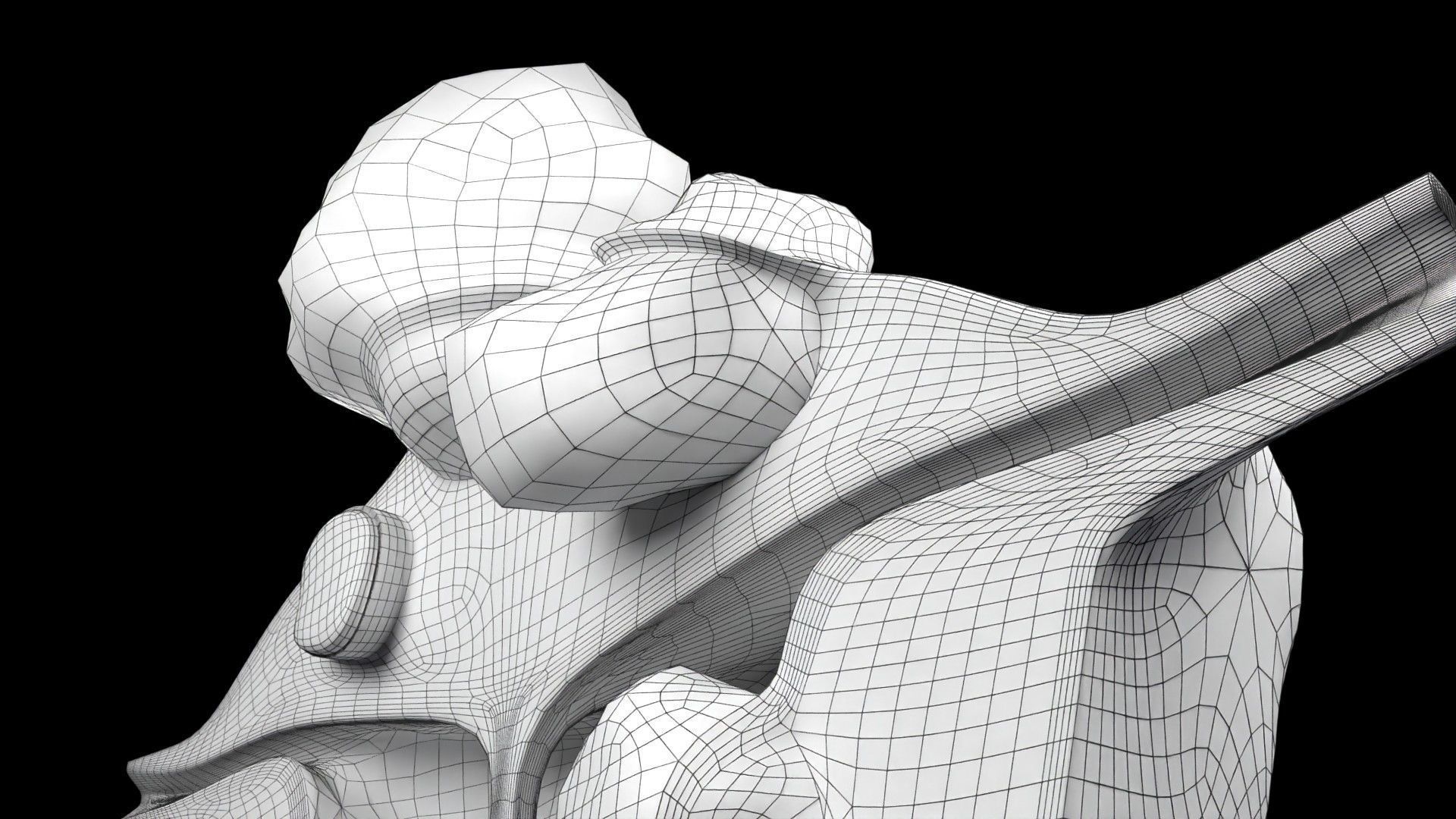 Fibroid Uterus Human female 3D Low-poly 3D model_63