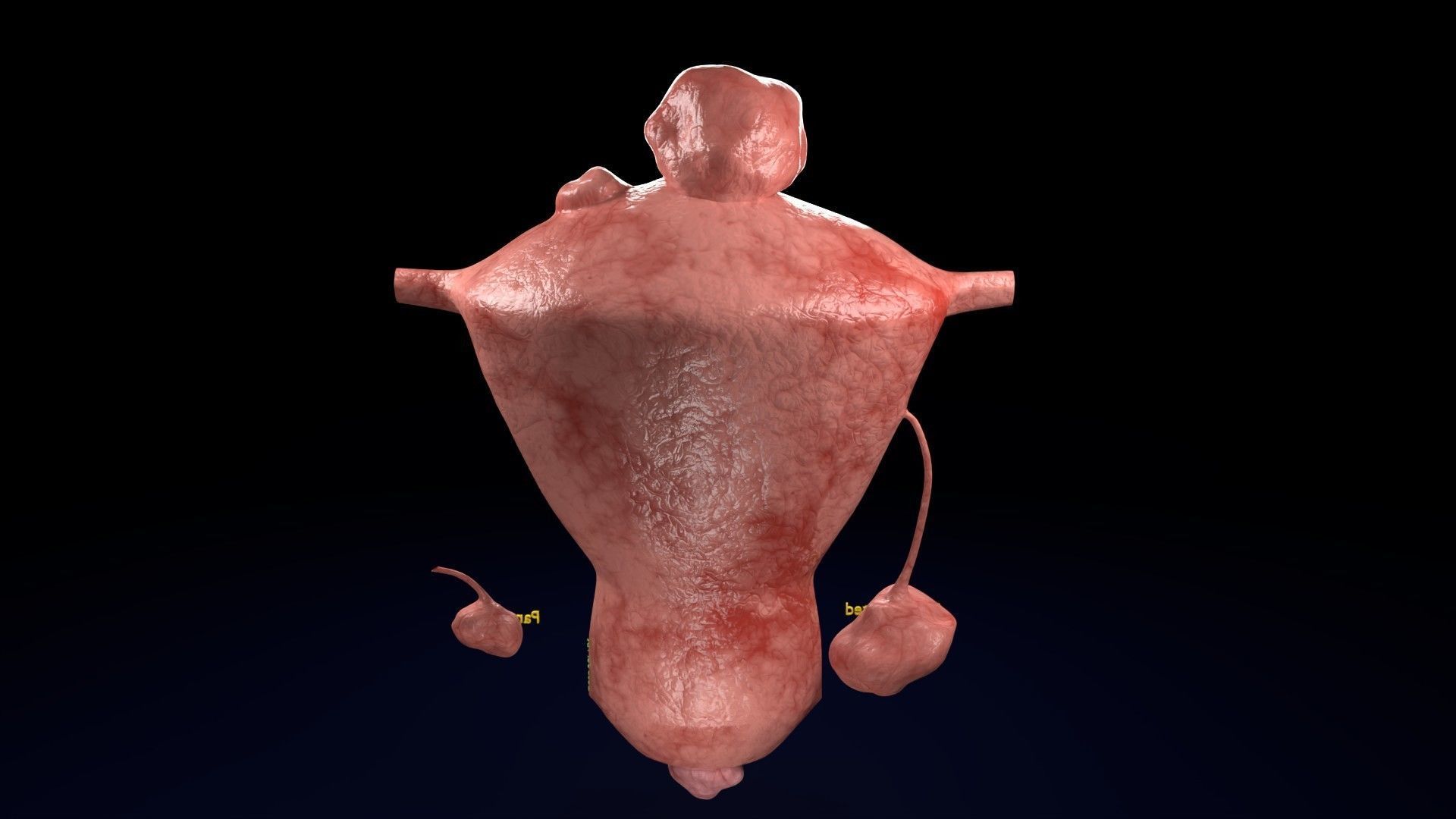 Fibroid Uterus Human female 3D Low-poly 3D model_20