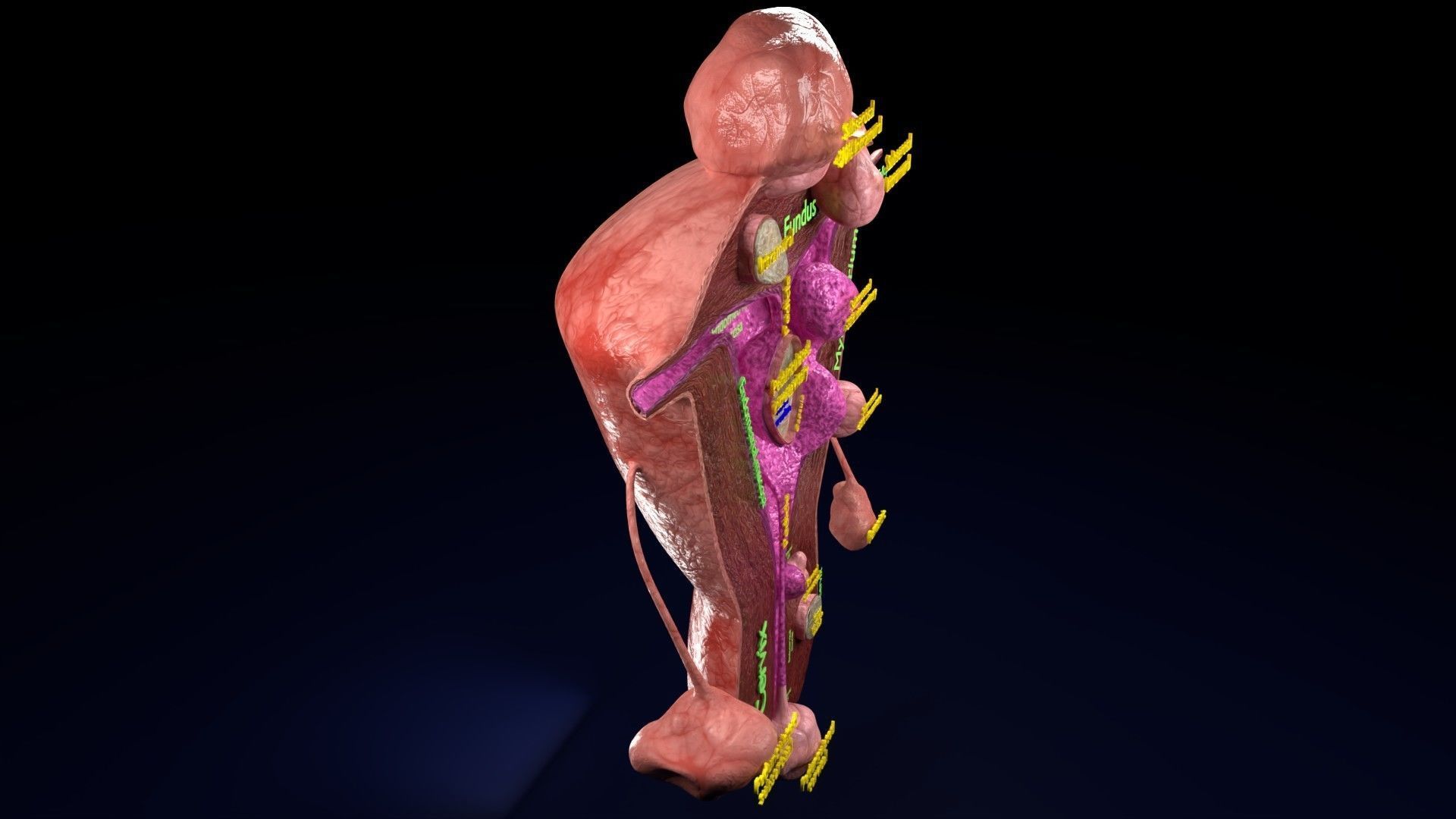 Fibroid Uterus Human female 3D Low-poly 3D model_36
