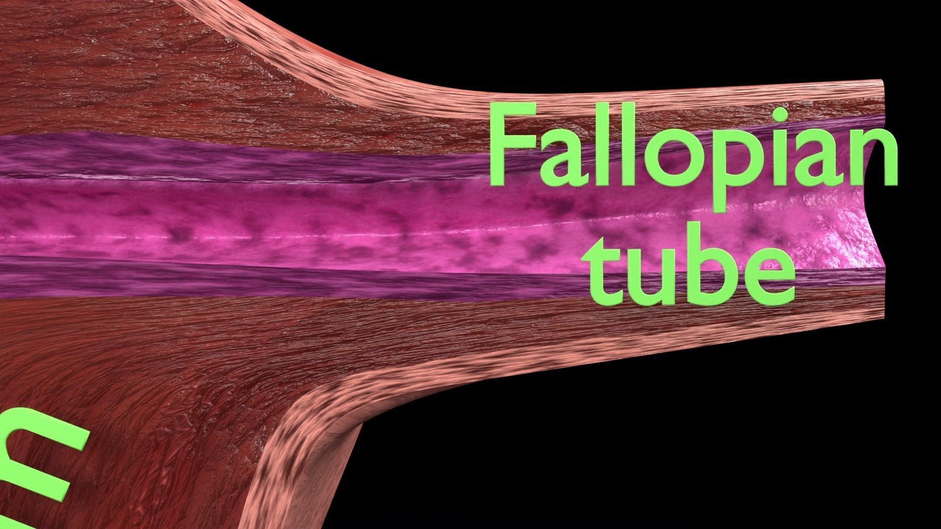 Fibroid Uterus Human female 3D Low-poly 3D model_2