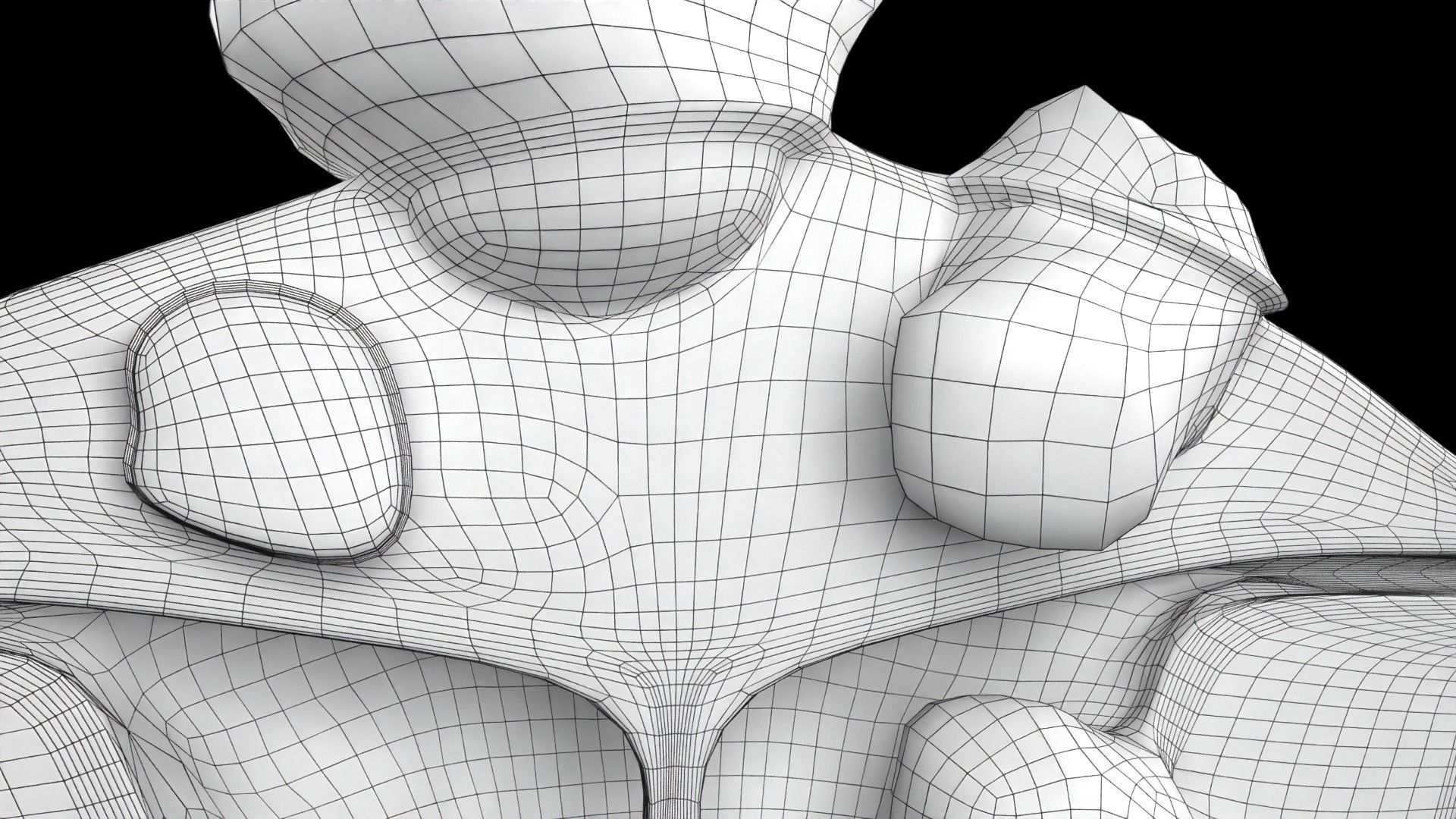 Fibroid Uterus Human female 3D Low-poly 3D model_59