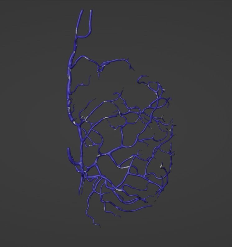 3D Model of Canine Brain with Arteries 3D model_9