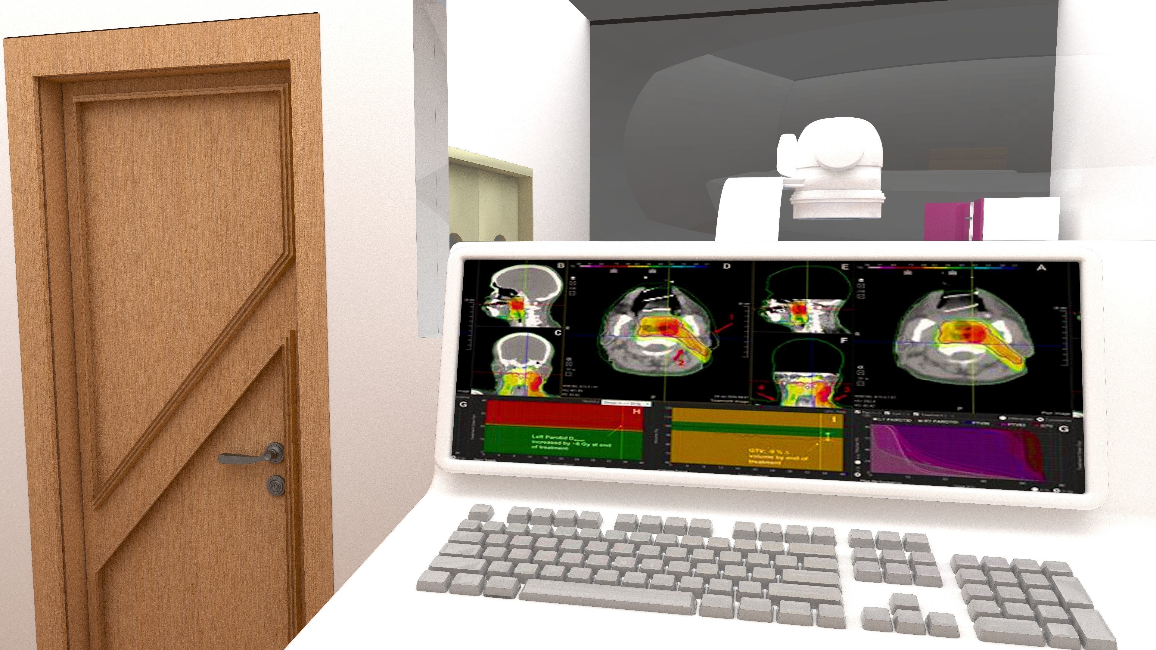Radiotherapy Unit 4K 3D model_3