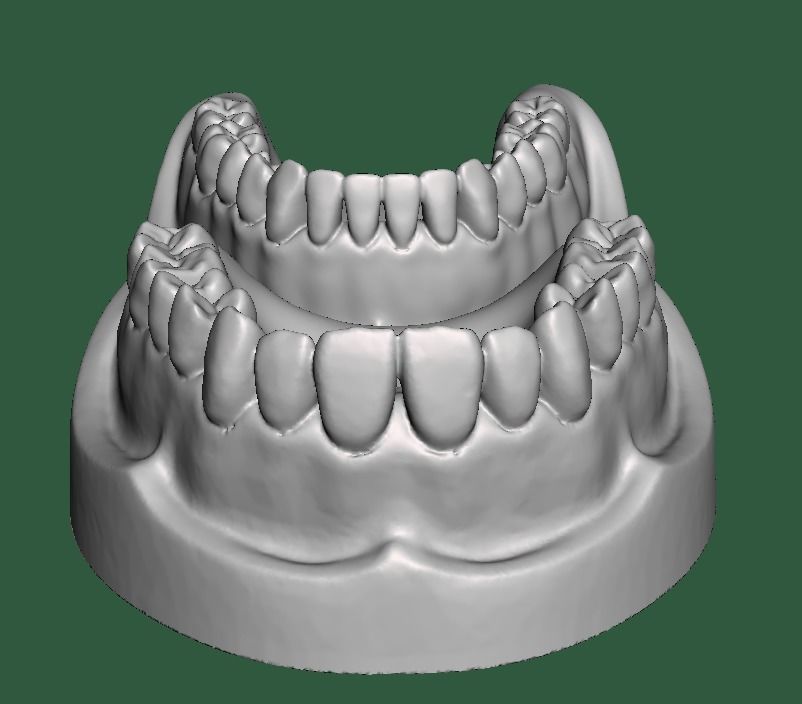 D0015 Dental model upper and lower solid model for test print Free 3D print model_3