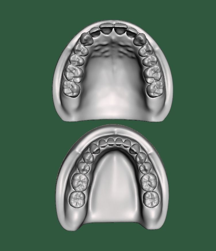 D0015 Dental model upper and lower solid model for test print free 3D ...