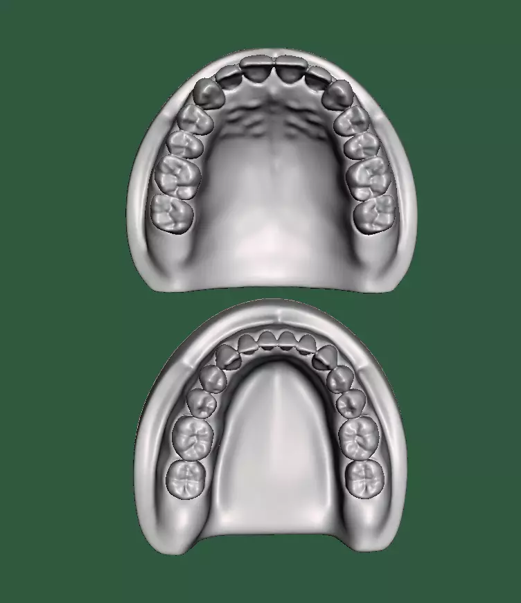 D0015 Dental model upper and lower solid model for test print Free 3D print model_0