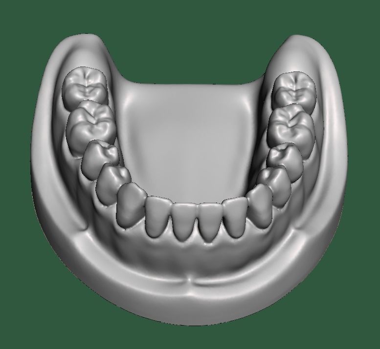 D0015 Dental model upper and lower solid model for test print Free 3D print model_4
