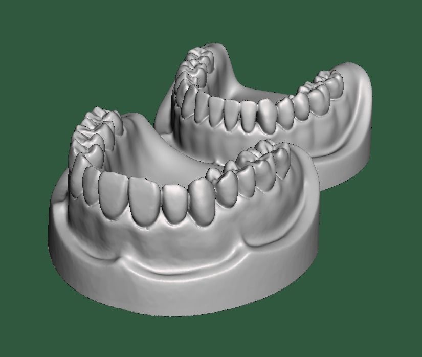 D0015 Dental model upper and lower solid model for test print Free 3D print model_1