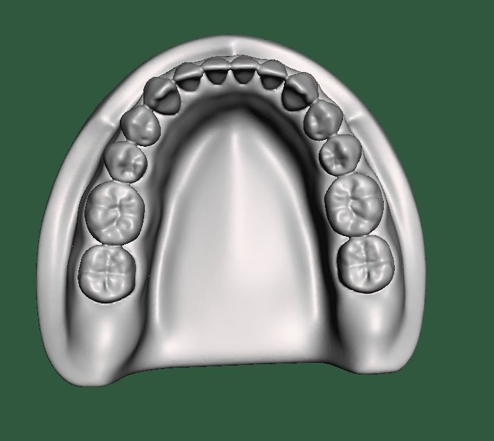 D0015 Dental model upper and lower solid model for test print Free 3D print model_7