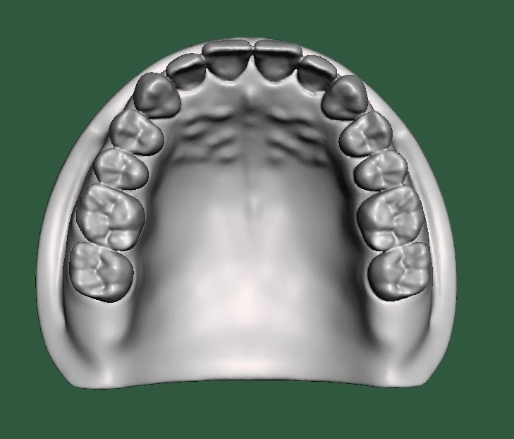 D0015 Dental model upper and lower solid model for test print Free 3D print model_6