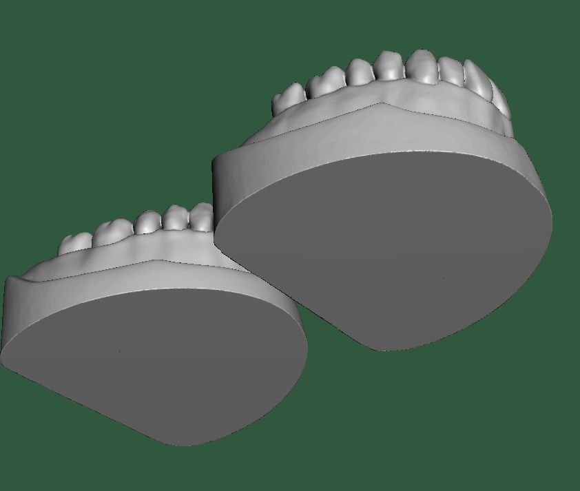 D0015 Dental model upper and lower solid model for test print Free 3D print model_2