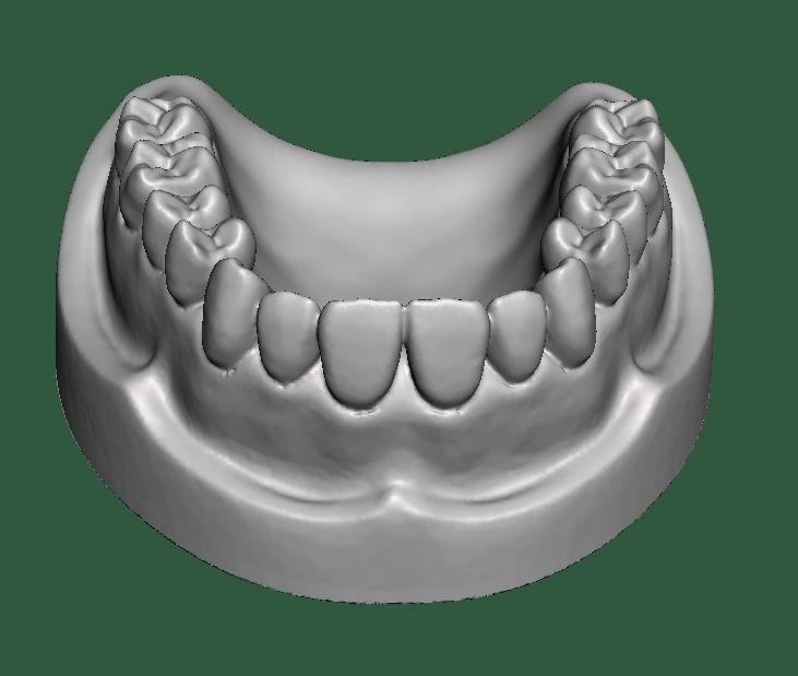 D0015 Dental model upper and lower solid model for test print Free 3D print model_5