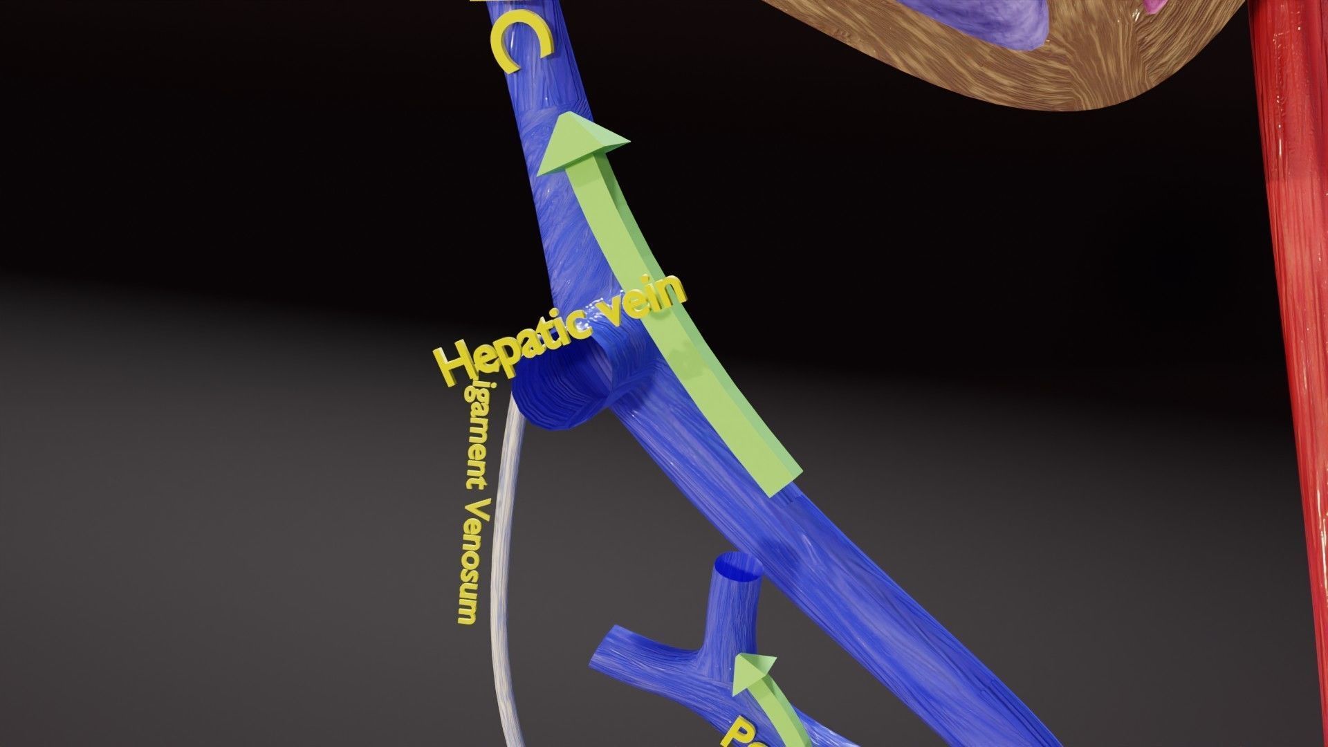 TAF Tetralogy of Fallot vs Normal circulation Low-poly 3D model_37