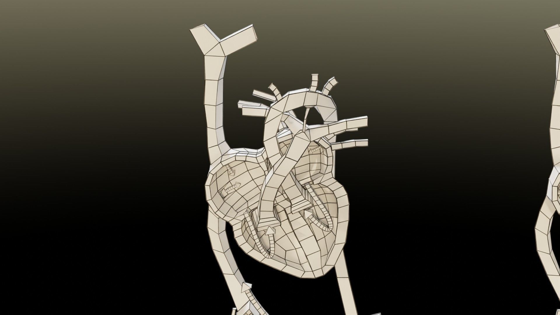 TAF Tetralogy of Fallot vs Normal circulation Low-poly 3D model_53