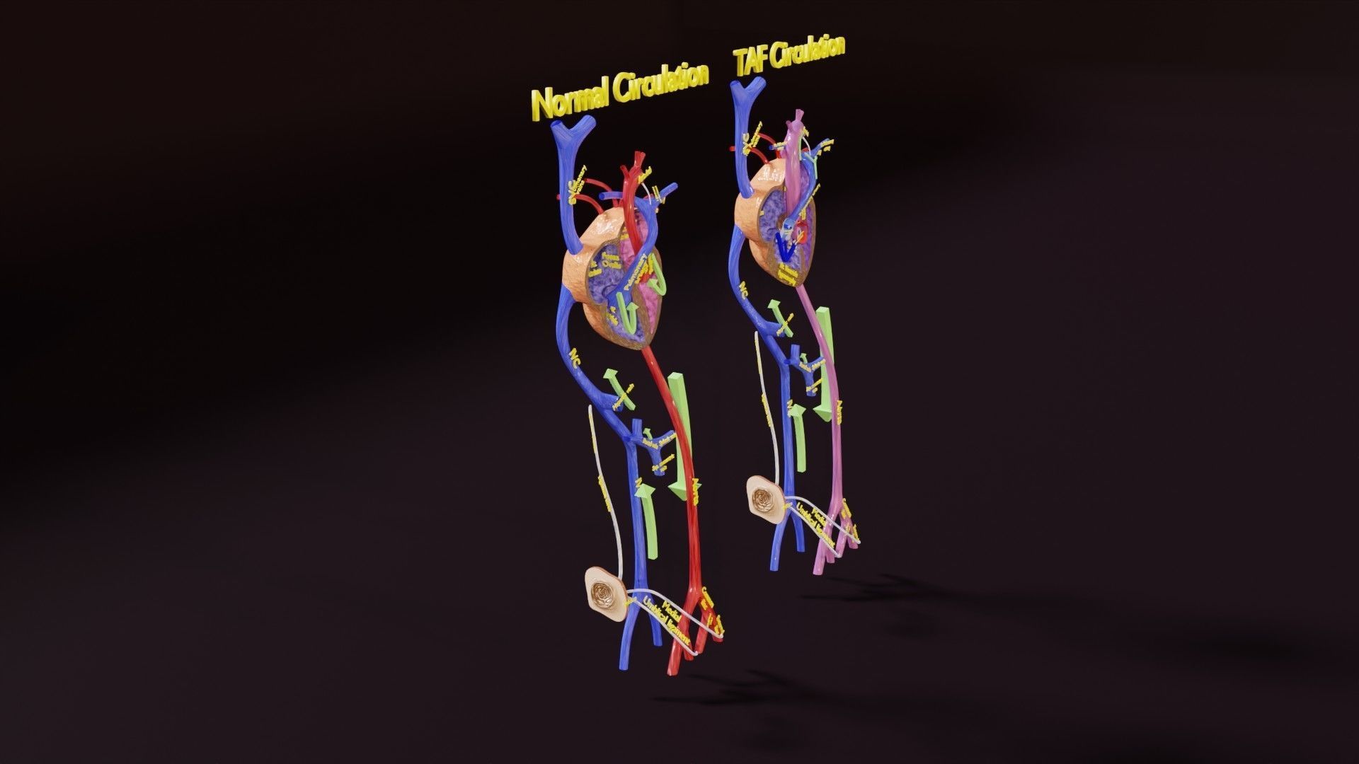 TAF Tetralogy of Fallot vs Normal circulation Low-poly 3D model_8