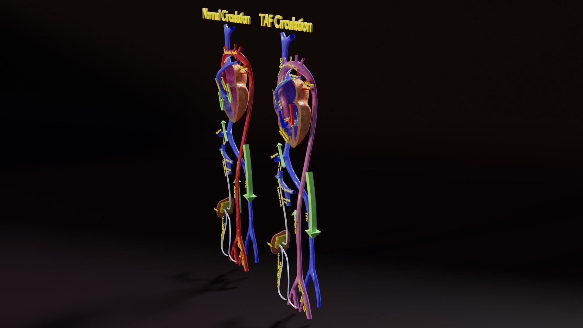 TAF Tetralogy of Fallot vs Normal circulation Low-poly 3D model_6