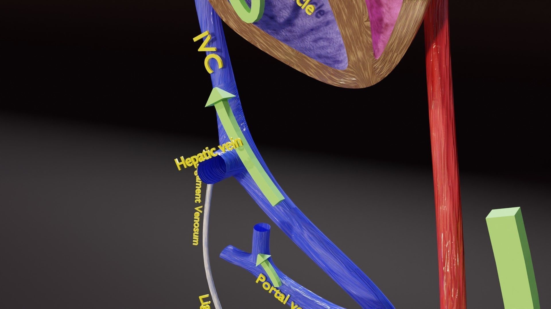 TAF Tetralogy of Fallot vs Normal circulation Low-poly 3D model_29