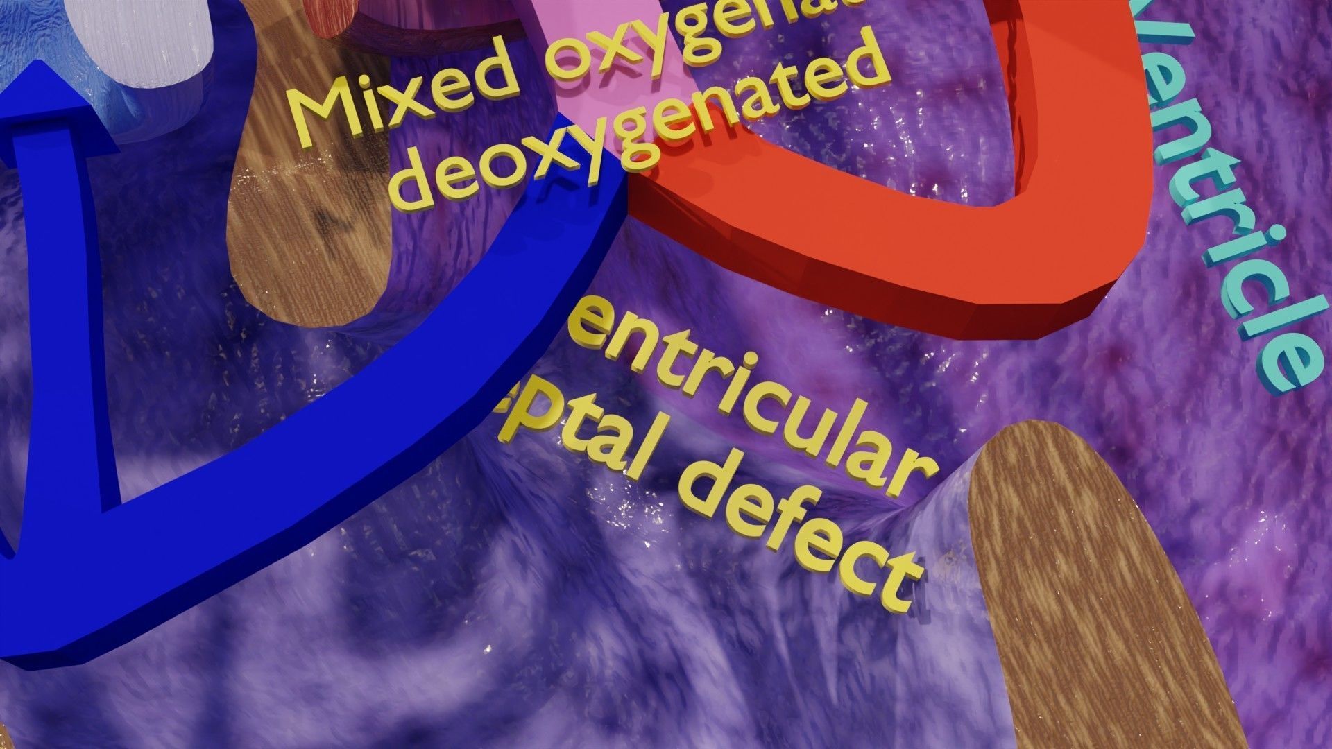 TAF Tetralogy of Fallot vs Normal circulation Low-poly 3D model_16