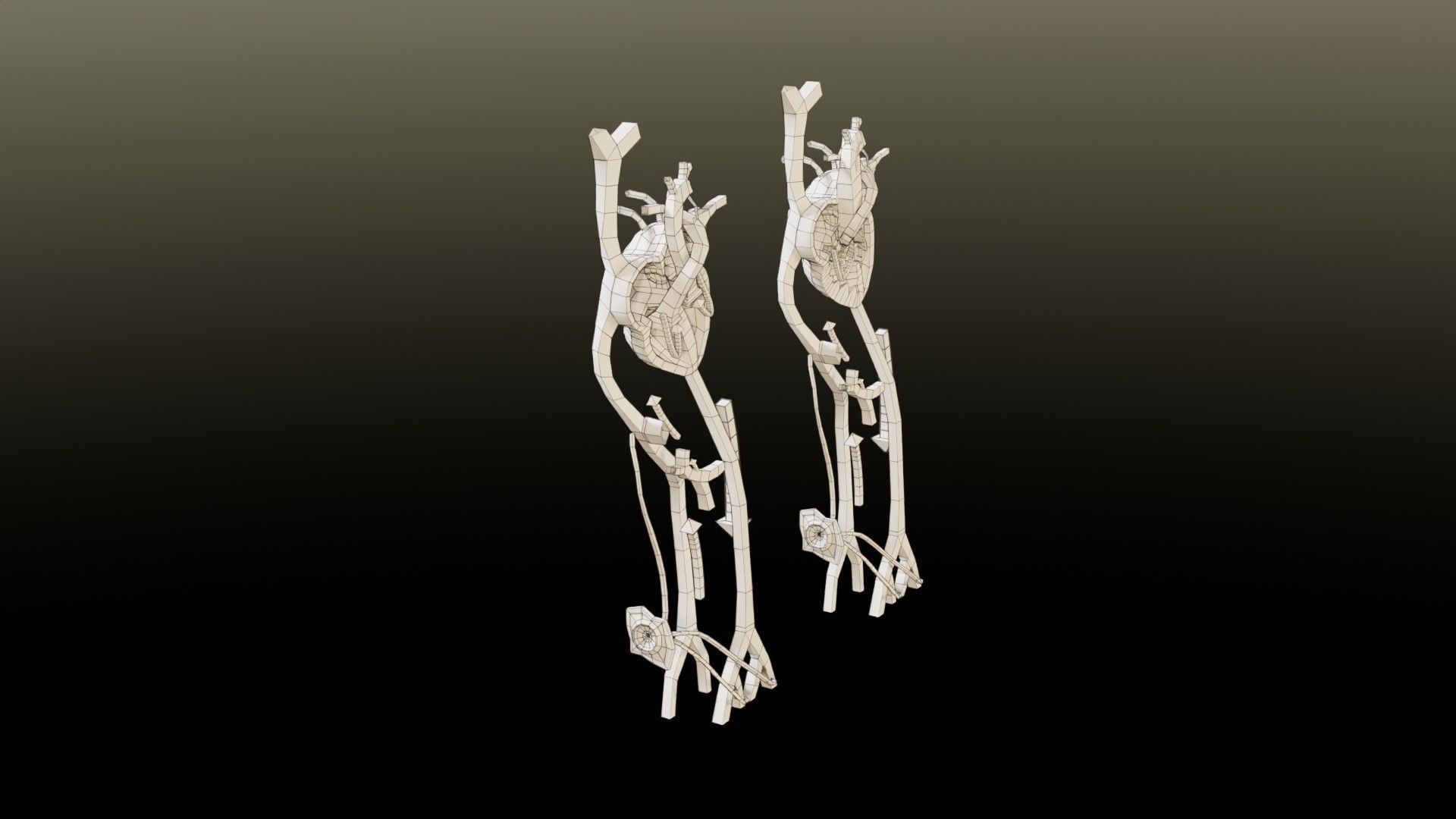 TAF Tetralogy of Fallot vs Normal circulation Low-poly 3D model_44
