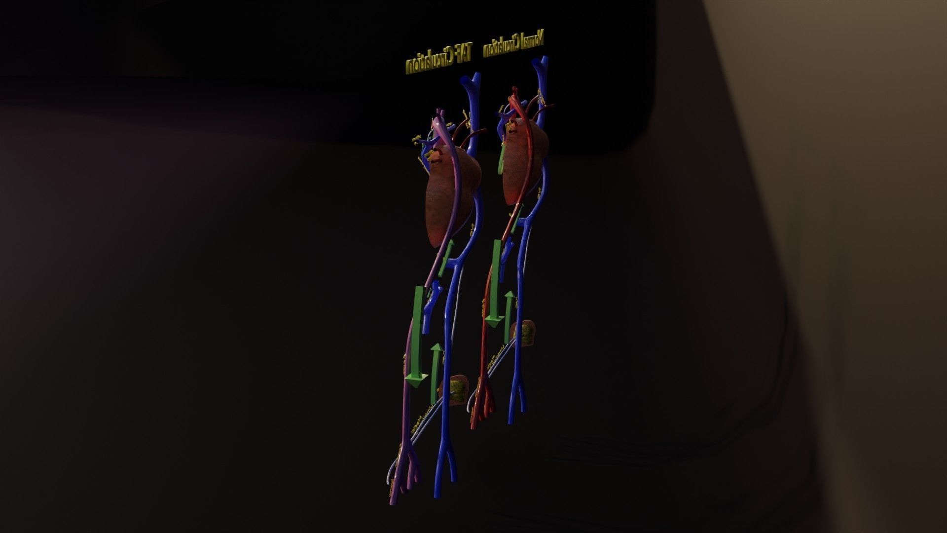 TAF Tetralogy of Fallot vs Normal circulation Low-poly 3D model_7