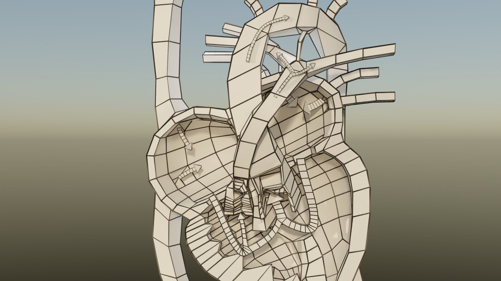 TAF Tetralogy of Fallot vs Normal circulation Low-poly 3D model_47