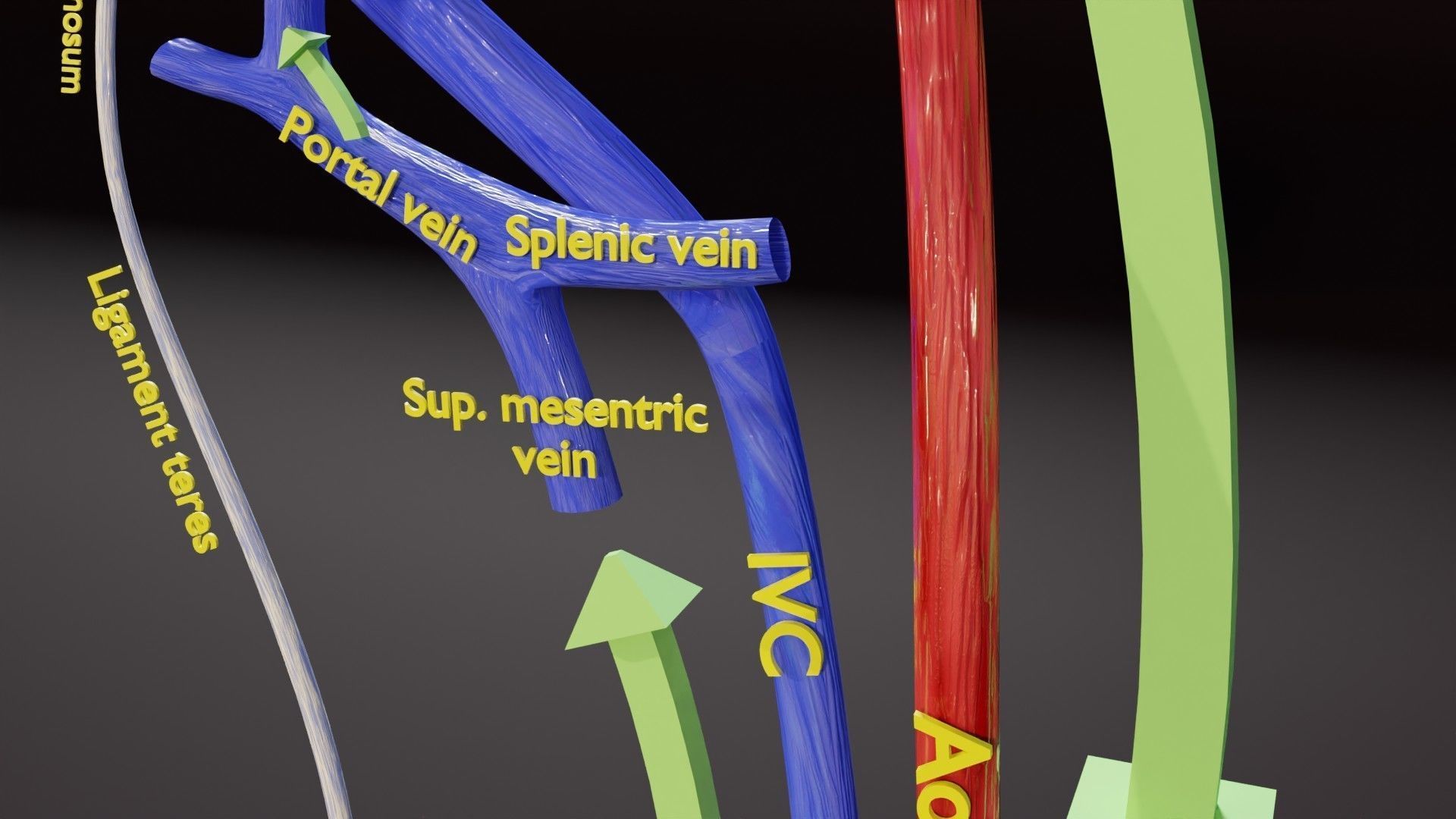 TAF Tetralogy of Fallot vs Normal circulation Low-poly 3D model_36