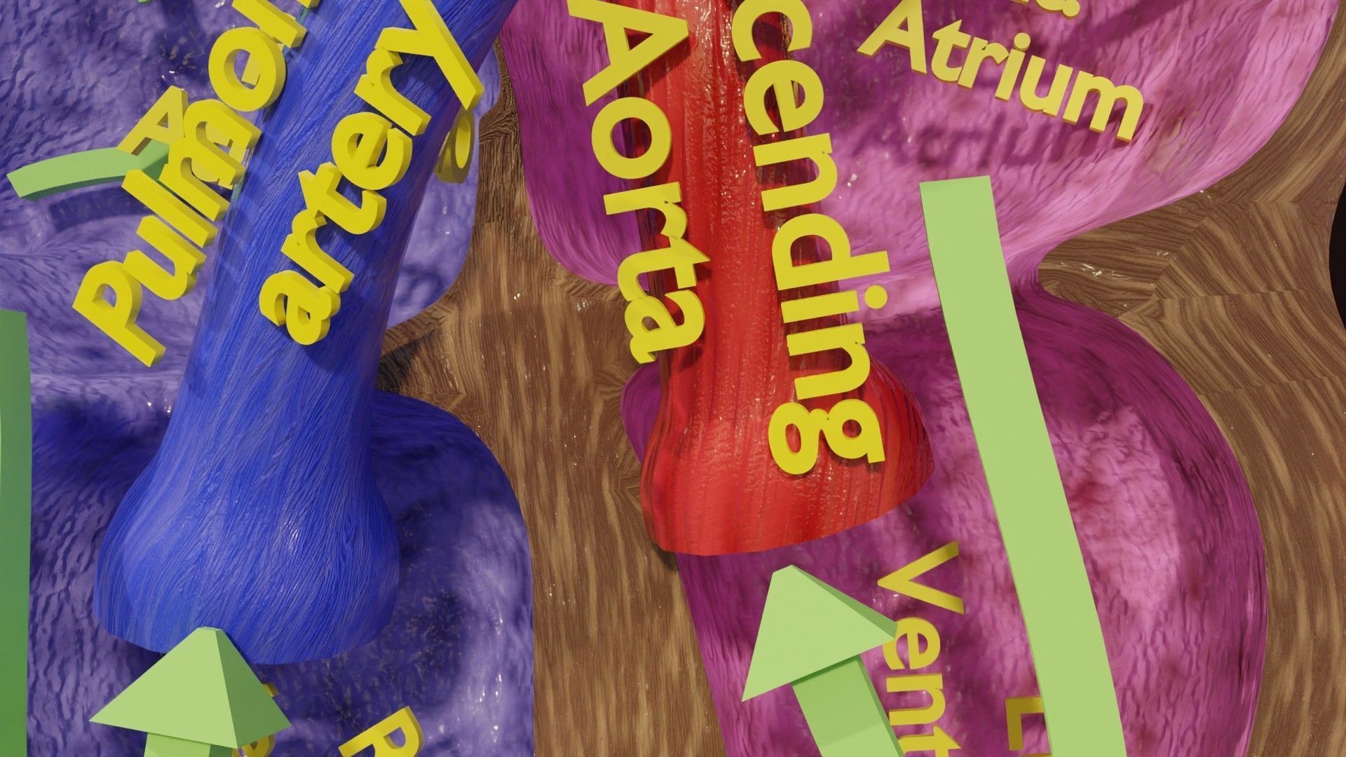 TAF Tetralogy of Fallot vs Normal circulation Low-poly 3D model_32