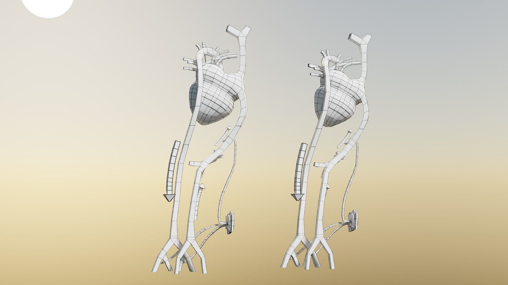 TAF Tetralogy of Fallot vs Normal circulation Low-poly 3D model_61