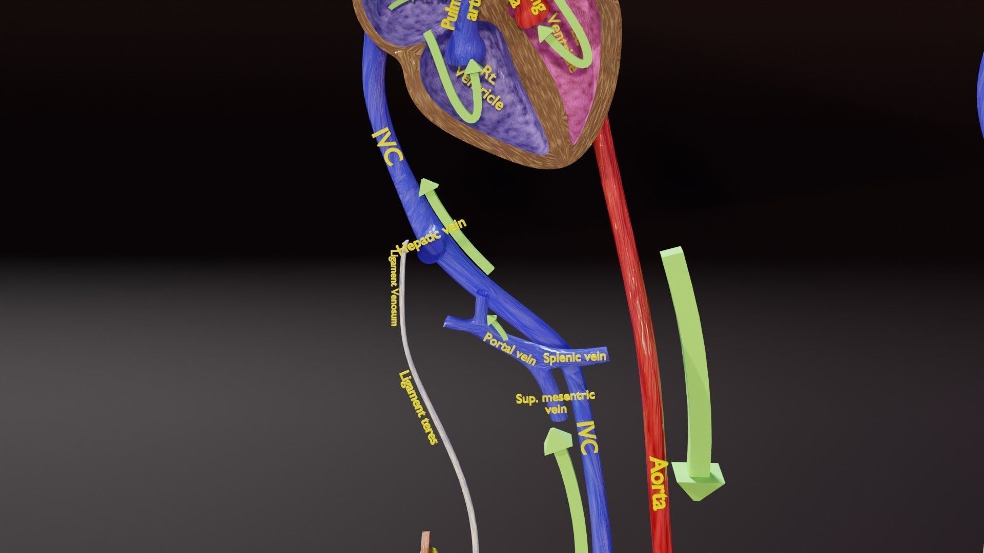 TAF Tetralogy of Fallot vs Normal circulation Low-poly 3D model_25