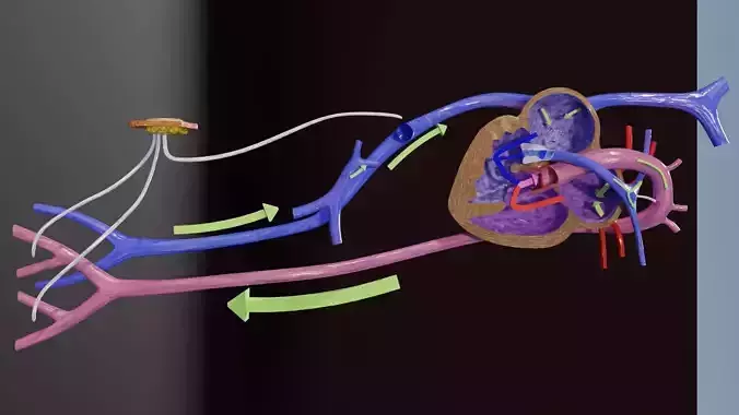 TAF Tetralogy of Fallot vs Normal circulation Low-poly 3D model
